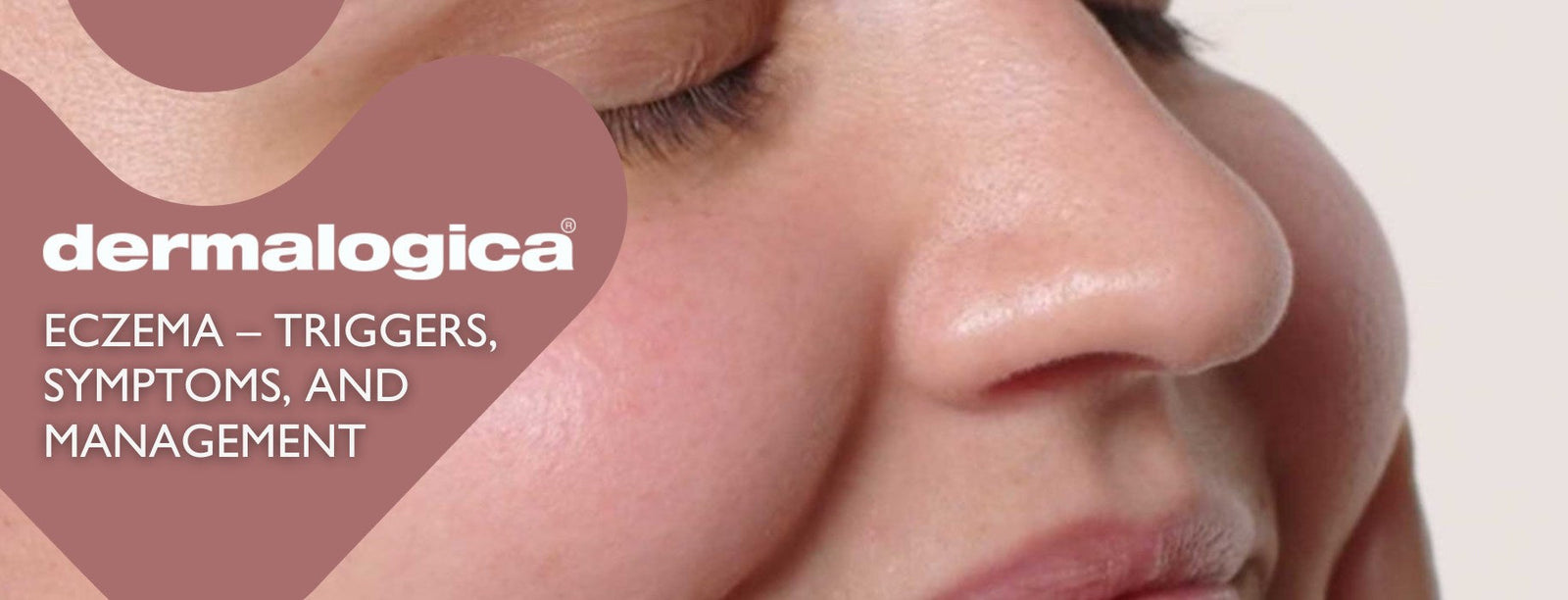 understanding-eczema-triggers-symptoms-and-management