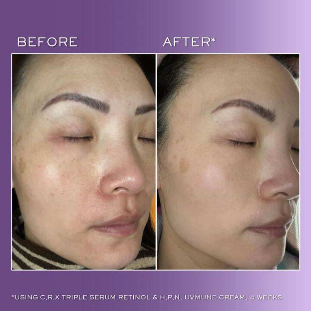 Lancôme Rénergie C.R.X. Triple Serum Retinol 50ml