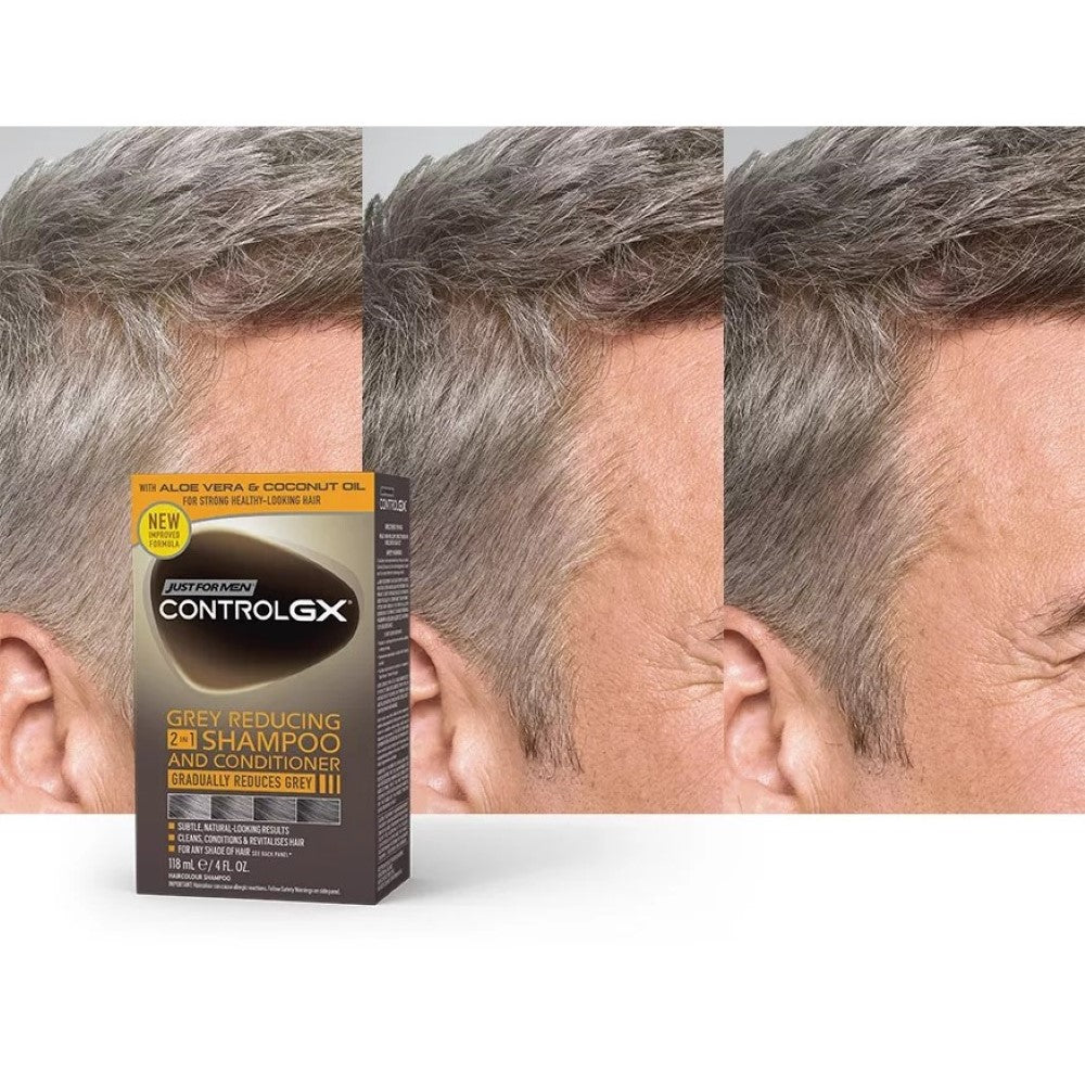 jfm-control-gx-shampoo-and-conditioner-1420-02-6