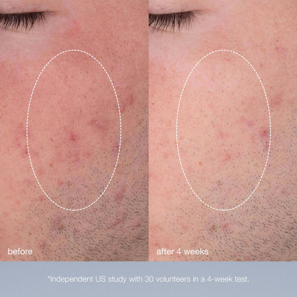 dermalogica-daily-microfoliant®-74g-8