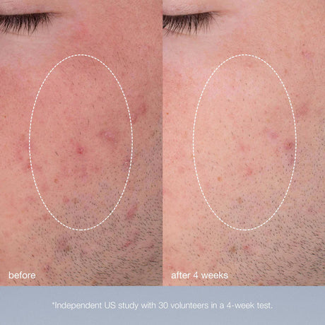 dermalogica-daily-microfoliant®-74g-8