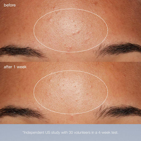 dermalogica-daily-microfoliant®-74g-9