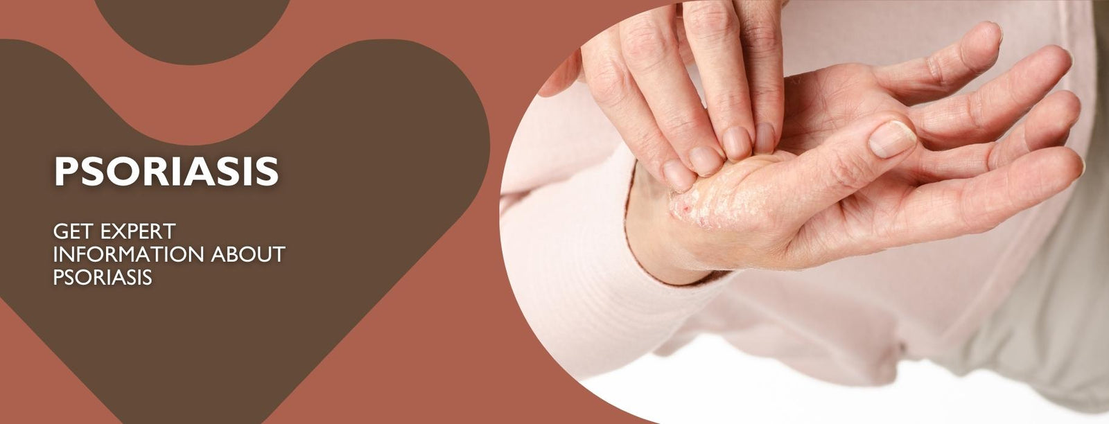 psoriasis-the-facts-information-on-psoriasis