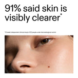 the-inkey-list-blemish-clearing-solution-2-novoretin-50ml-1096831-3