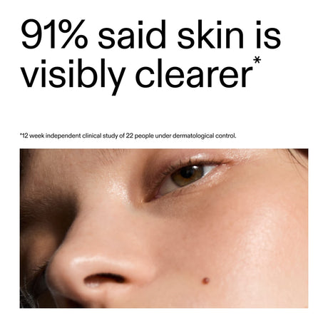 the-inkey-list-blemish-clearing-solution-2-novoretin-50ml-1096831-3