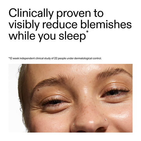 the-inkey-list-blemish-clearing-solution-2-novoretin-50ml-1096831-4