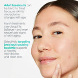 dermalogica-breakout-biotic-moisturiser-50ml-8
